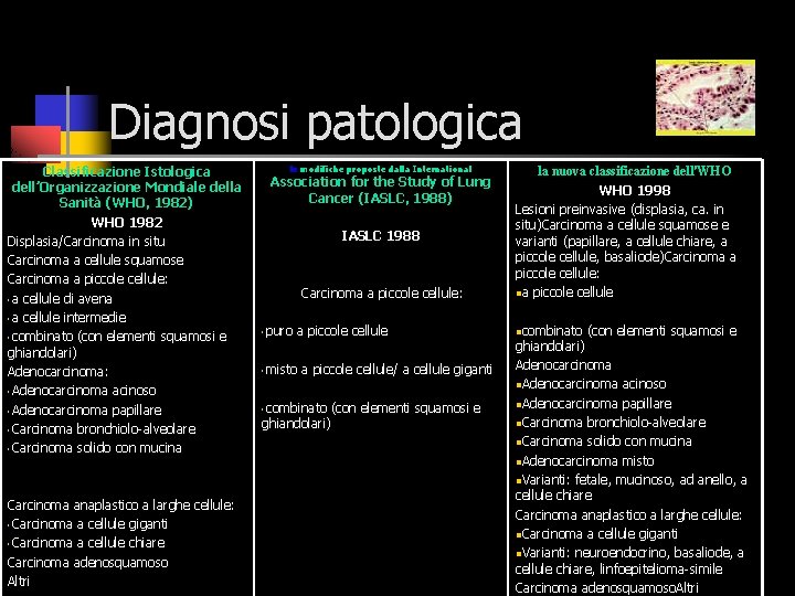 Diagnosi patologica Classificazione Istologica dell’Organizzazione Mondiale della Sanità (WHO, 1982) WHO 1982 Displasia/Carcinoma in