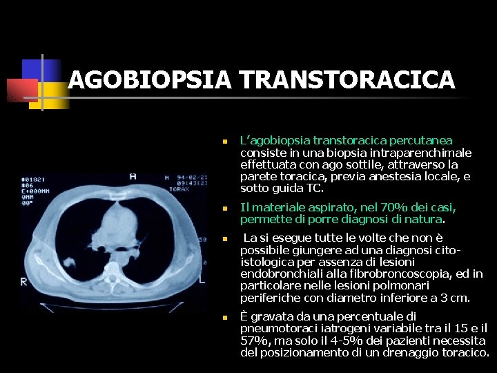 AGOBIOPSIA TRANSTORACICA n n L’agobiopsia transtoracica percutanea consiste in una biopsia intraparenchimale effettuata con