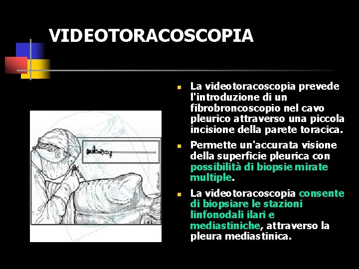 VIDEOTORACOSCOPIA n n n La videotoracoscopia prevede l'introduzione di un fibrobroncoscopio nel cavo pleurico
