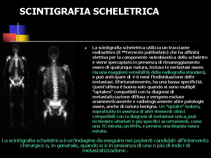 SCINTIGRAFIA SCHELETRICA n La scintigrafia scheletrica utilizza un tracciante radioattivo (il 99 Tecnezio polifosfato)