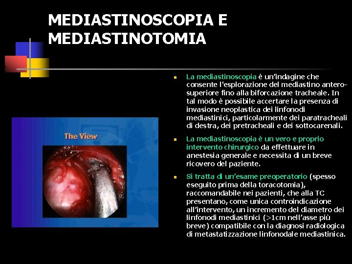 MEDIASTINOSCOPIA E MEDIASTINOTOMIA n n n La mediastinoscopia è un’indagine che consente l'esplorazione del