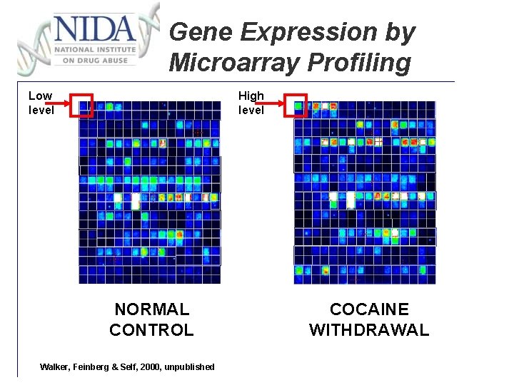 Gene Expression by Microarray Profiling Low level High level NORMAL CONTROL Walker, Feinberg &