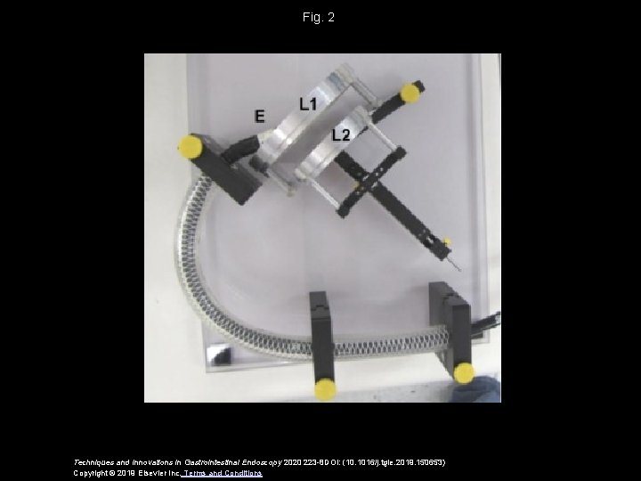 Fig. 2 Techniques and Innovations in Gastrointestinal Endoscopy 2020 223 -8 DOI: (10. 1016/j.