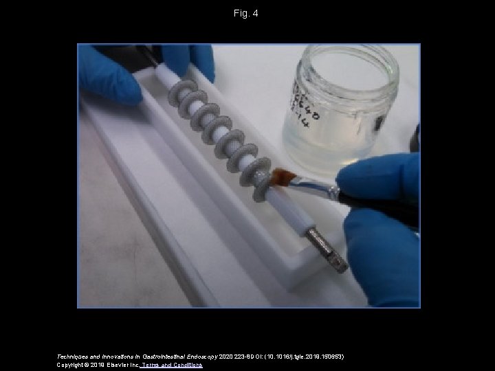 Fig. 4 Techniques and Innovations in Gastrointestinal Endoscopy 2020 223 -8 DOI: (10. 1016/j.