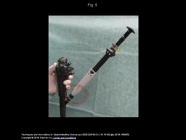 Fig. 5 Techniques and Innovations in Gastrointestinal Endoscopy 2020 223 -8 DOI: (10. 1016/j.