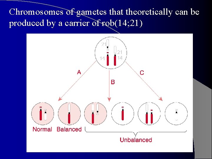 Chromosomes of gametes that theoretically can be produced by a carrier of rob(14; 21)