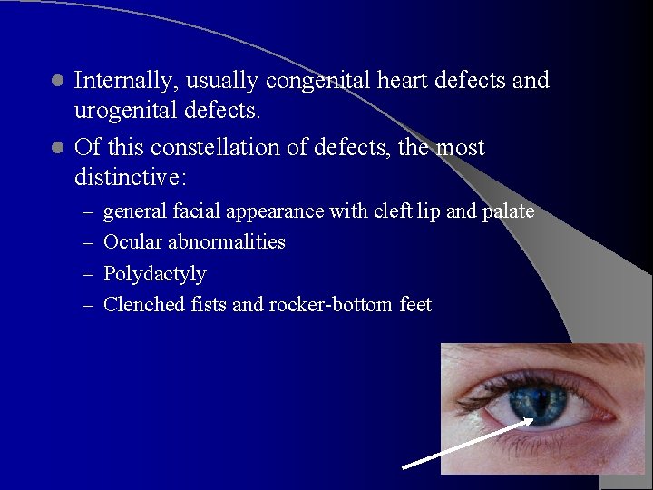 Internally, usually congenital heart defects and urogenital defects. l Of this constellation of defects,