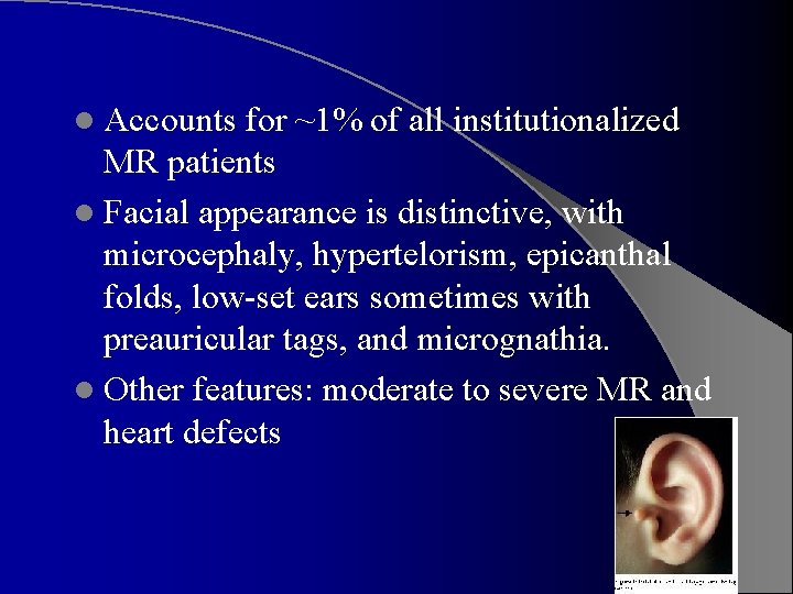 l Accounts for ~1% of all institutionalized MR patients l Facial appearance is distinctive,