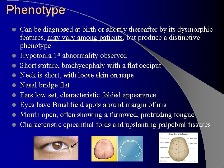 Phenotype l l l l l Can be diagnosed at birth or shortly thereafter