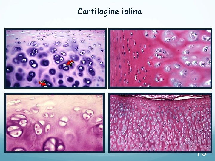 Cartilagine ialina 18 Cartilagine ialina 18