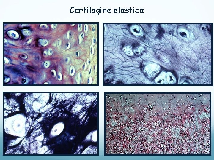 Cartilagine elastica 21 Cartilagine elastica 21