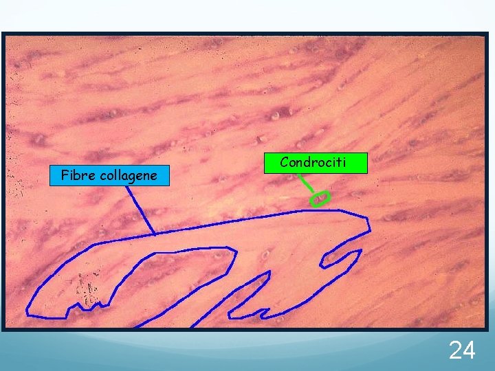 Fibre collagene Condrociti 24 Fibre collagene Condrociti 24