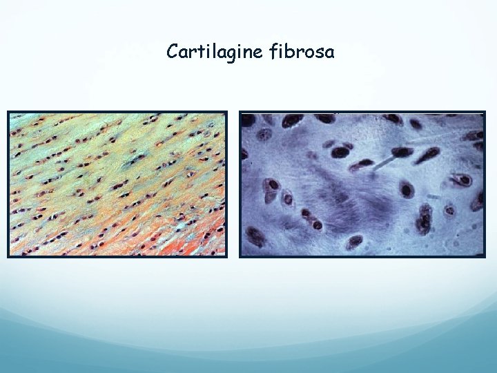 Cartilagine fibrosa Cartilagine fibrosa