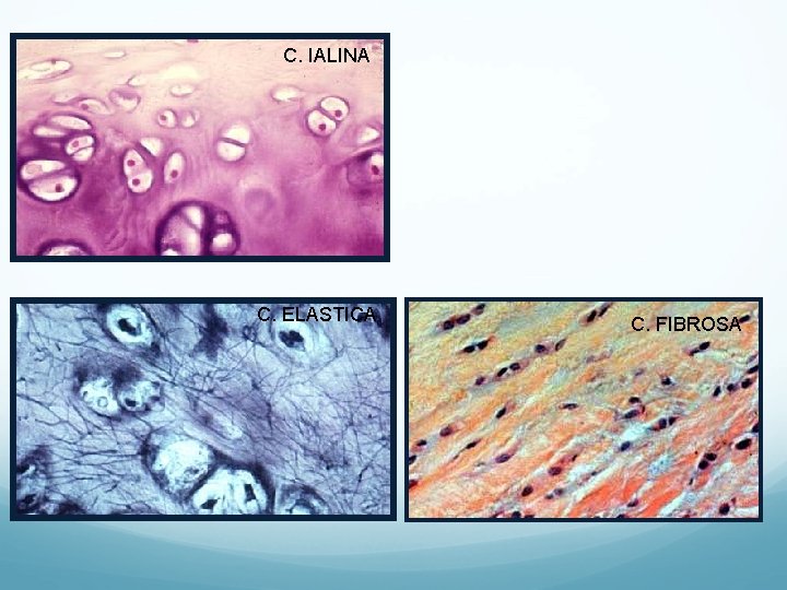 C. IALINA C. ELASTICA C. FIBROSA C. IALINA C. ELASTICA C. FIBROSA