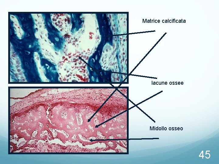 Matrice calcificata lacune ossee Midollo osseo 45 Matrice calcificata lacune ossee Midollo osseo 45