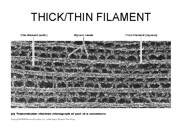 THICK/THIN FILAMENT 