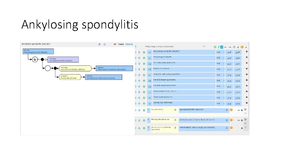 Ankylosing spondylitis 