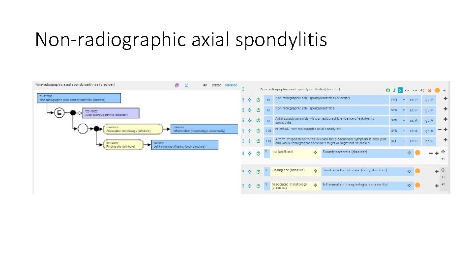 Non-radiographic axial spondylitis 