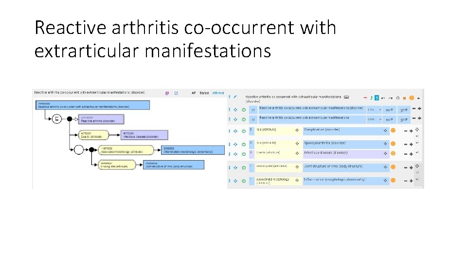 Reactive arthritis co-occurrent with extrarticular manifestations 