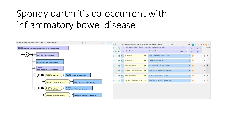 Spondyloarthritis co-occurrent with inflammatory bowel disease 