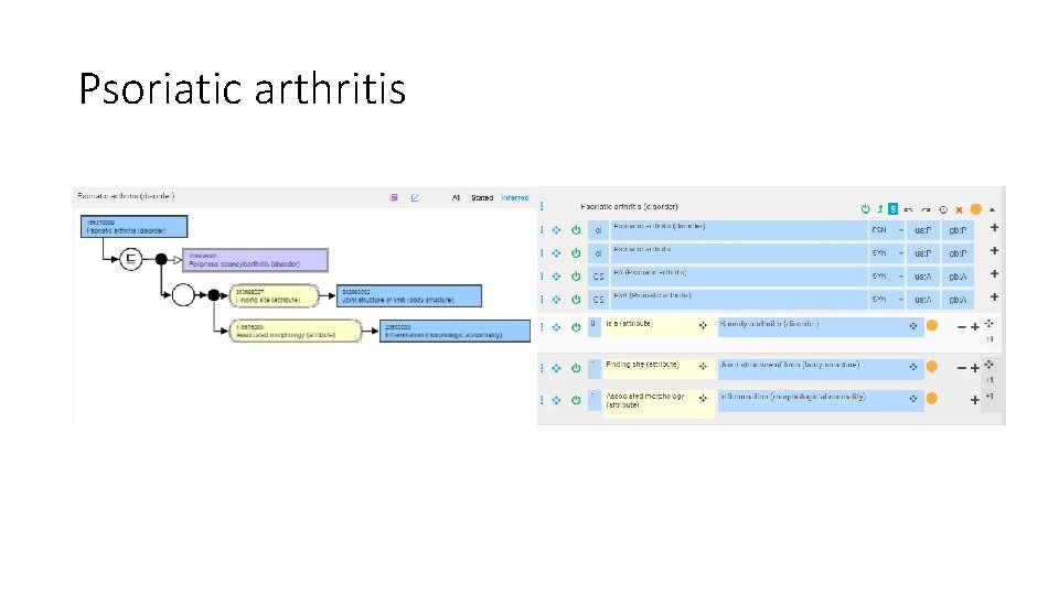 Psoriatic arthritis 