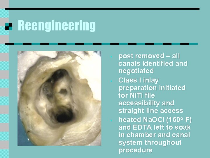 Reengineering § § § post removed – all canals identified and negotiated Class I Reengineering § § § post removed – all canals identified and negotiated Class I