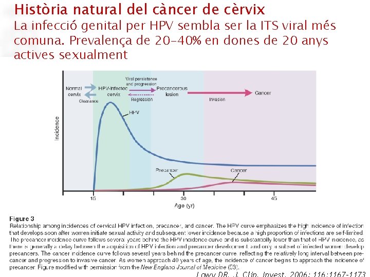 Història natural del càncer de cèrvix La infecció genital per HPV sembla ser la