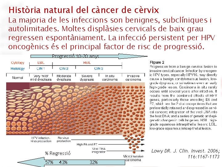 Història natural del càncer de cèrvix La majoria de les infeccions son benignes, subclíniques