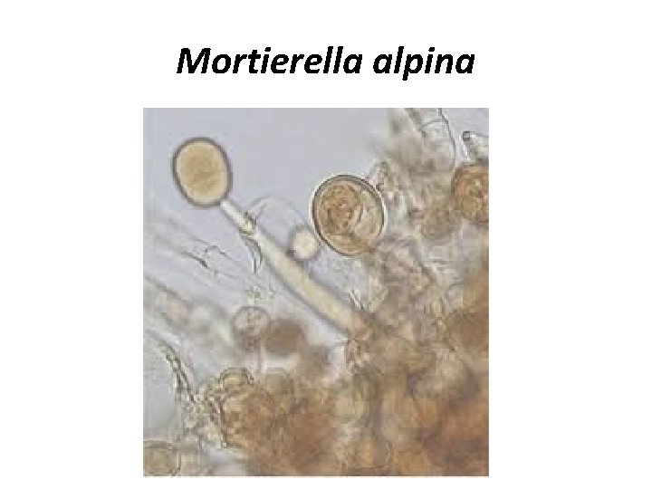 Mortierella alpina 