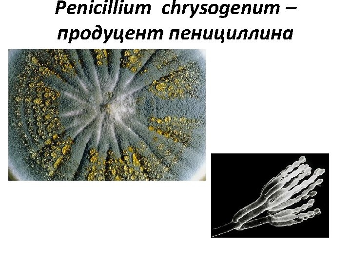 Penicillium chrysogenum