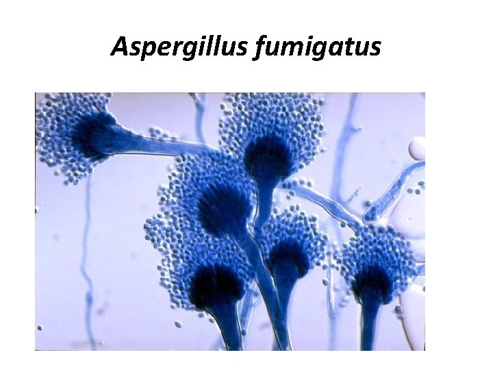 Аspergillus fumigatus 