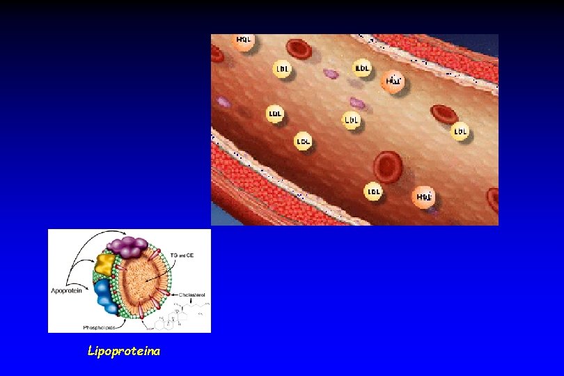 Lipoproteina 
