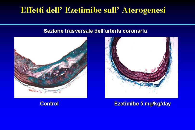 Effetti dell’ Ezetimibe sull’ Aterogenesi Sezione trasversale dell’arteria coronaria Control Ezetimibe 5 mg/kg/day 