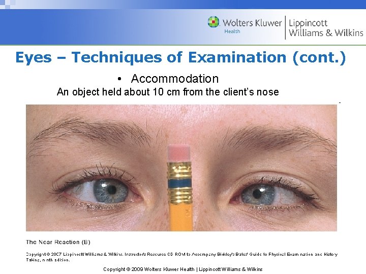 Eyes – Techniques of Examination (cont. ) • Accommodation An object held about 10