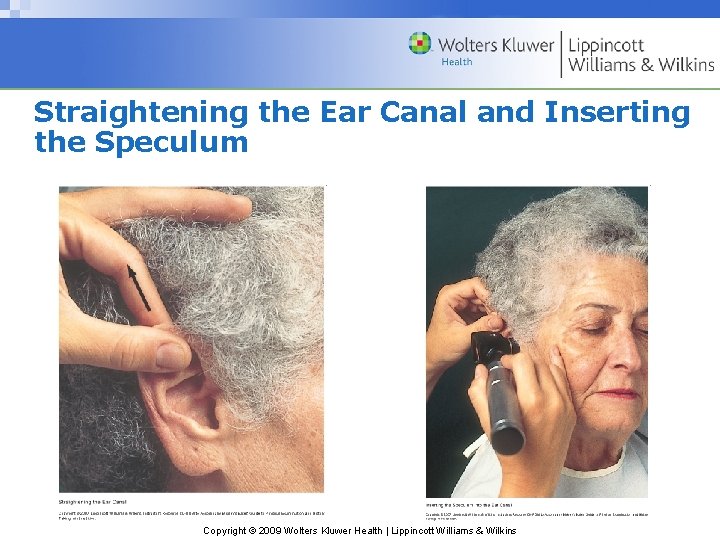Straightening the Ear Canal and Inserting the Speculum Copyright © 2009 Wolters Kluwer Health Straightening the Ear Canal and Inserting the Speculum Copyright © 2009 Wolters Kluwer Health