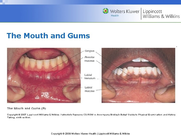 The Mouth and Gums Copyright © 2009 Wolters Kluwer Health | Lippincott Williams & The Mouth and Gums Copyright © 2009 Wolters Kluwer Health | Lippincott Williams &