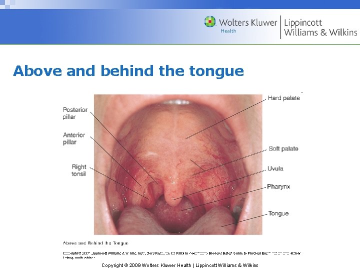 Above and behind the tongue Copyright © 2009 Wolters Kluwer Health | Lippincott Williams Above and behind the tongue Copyright © 2009 Wolters Kluwer Health | Lippincott Williams