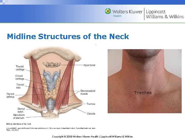 Midline Structures of the Neck Copyright © 2009 Wolters Kluwer Health | Lippincott Williams Midline Structures of the Neck Copyright © 2009 Wolters Kluwer Health | Lippincott Williams