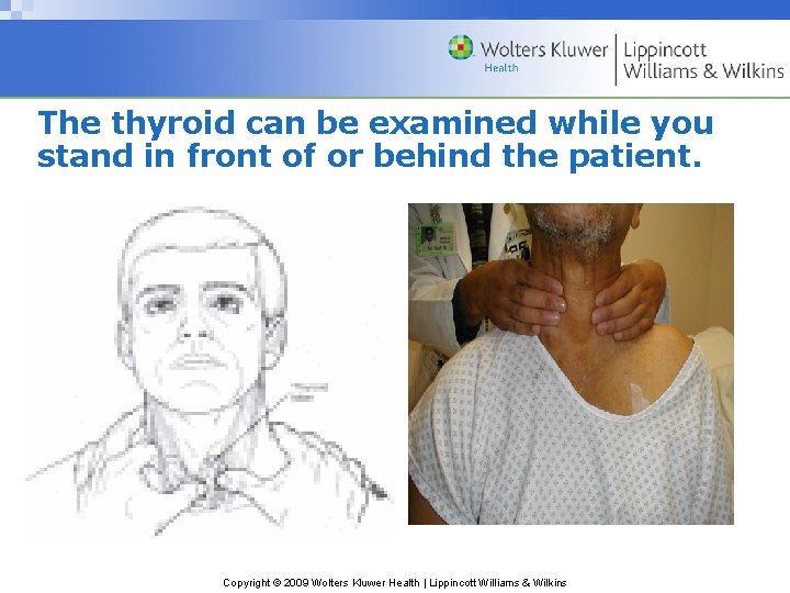 The thyroid can be examined while you stand in front of or behind the