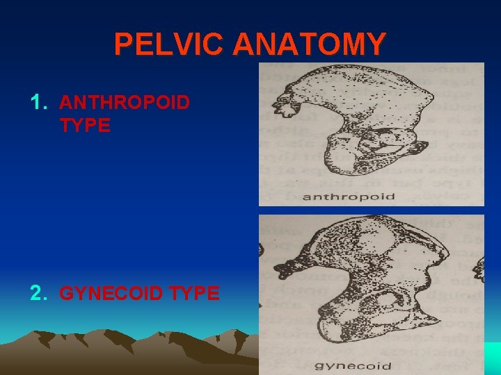 PELVIC ANATOMY 1. ANTHROPOID TYPE 2. GYNECOID TYPE 