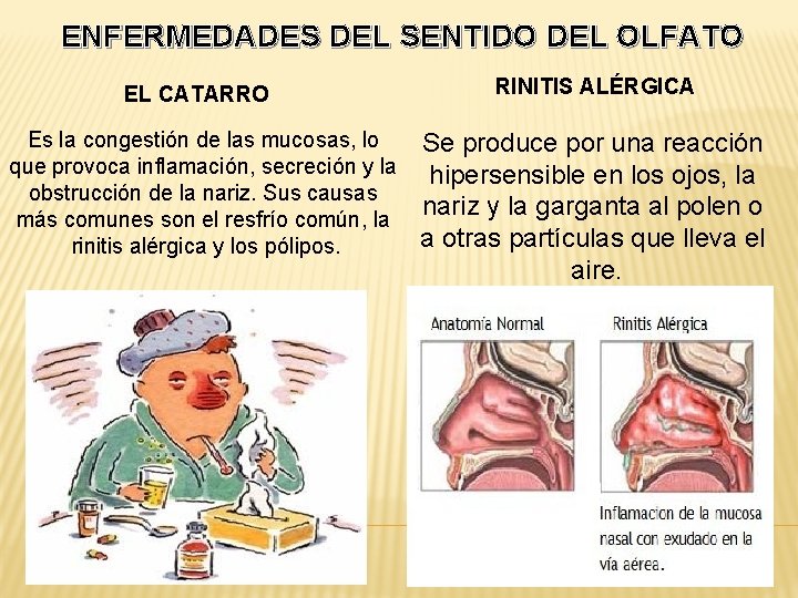 ENFERMEDADES DEL SENTIDO DEL OLFATO EL CATARRO Es la congestión de las mucosas, lo