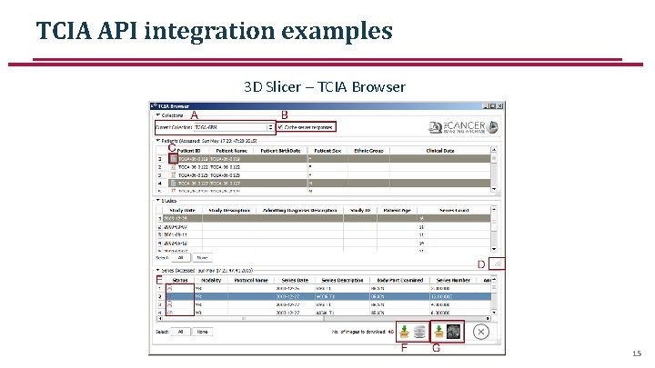 TCIA API integration examples 3 D Slicer – TCIA Browser 15 TCIA API integration examples 3 D Slicer – TCIA Browser 15