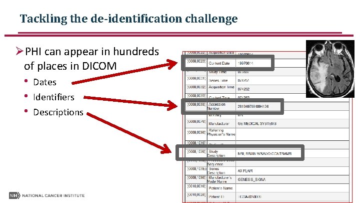 Tackling the de-identification challenge ØPHI can appear in hundreds of places in DICOM • Tackling the de-identification challenge ØPHI can appear in hundreds of places in DICOM •