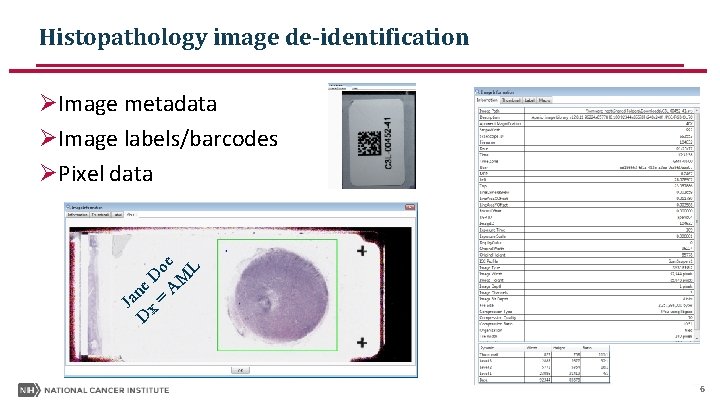 Histopathology image de-identification ØImage metadata ØImage labels/barcodes ØPixel data oe L D M e Histopathology image de-identification ØImage metadata ØImage labels/barcodes ØPixel data oe L D M e