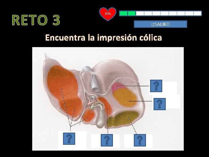 RETO 3 20% ¡¡SALIR!! Encuentra la impresión cólica 