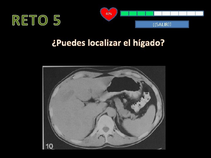 RETO 5 40% ¡¡SALIR!! ¿Puedes localizar el hígado? 