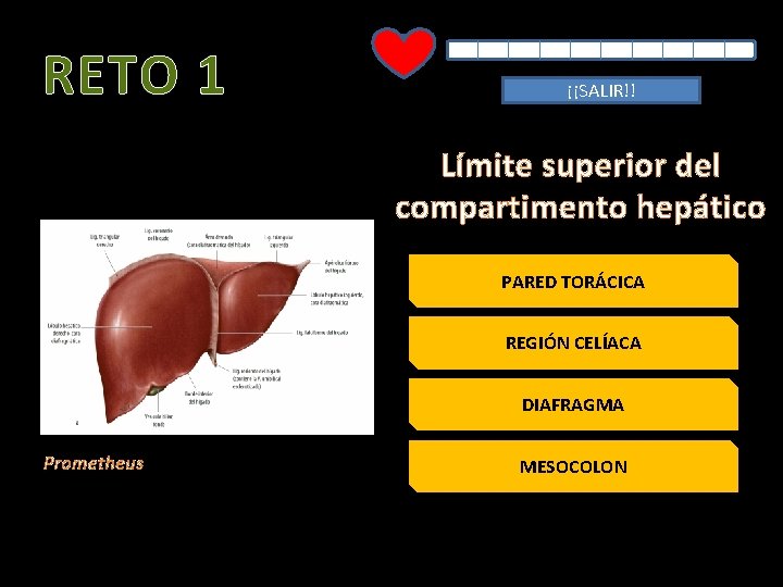 RETO 1 ¡¡SALIR!! Límite superior del compartimento hepático PARED TORÁCICA REGIÓN CELÍACA DIAFRAGMA Prometheus
