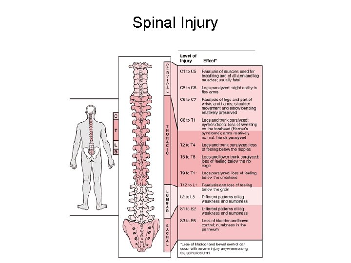 Spinal Injury 