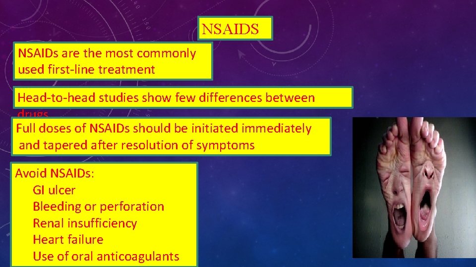 NSAIDS NSAIDs are the most commonly used first-line treatment Head-to-head studies show few differences