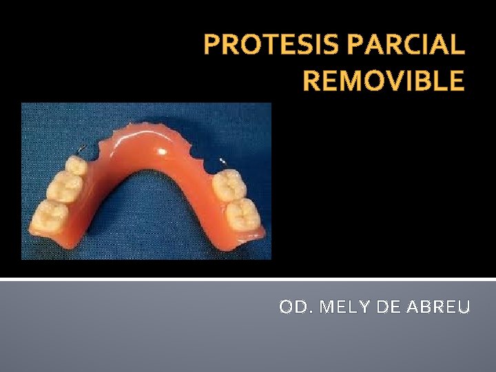 PROTESIS PARCIAL REMOVIBLE OD. MELY DE ABREU 